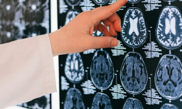 Living on the Edge: Why a Traumatic Brain Injury and High Anxiety Feel Like an Impossible Duo