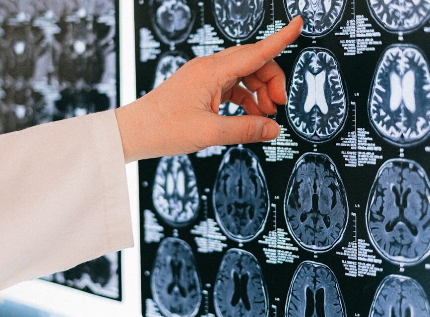 Living on the Edge: Why a Traumatic Brain Injury and High Anxiety Feel Like an Impossible Duo