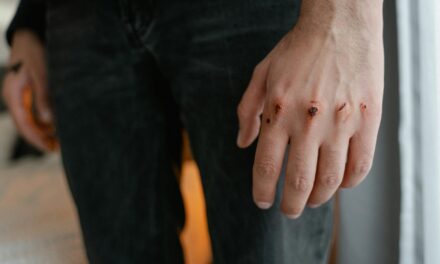 My TBI Is Not Just “Bad Anger.” It Is Emotional Lability, and It Has Ruined Parts of My Life