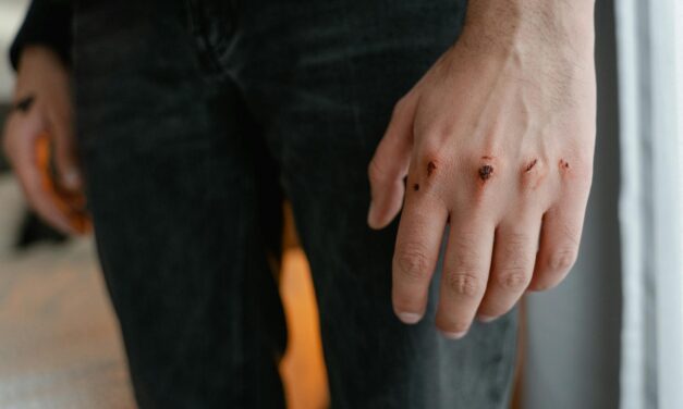 My TBI Is Not Just “Bad Anger.” It Is Emotional Lability, and It Has Ruined Parts of My Life